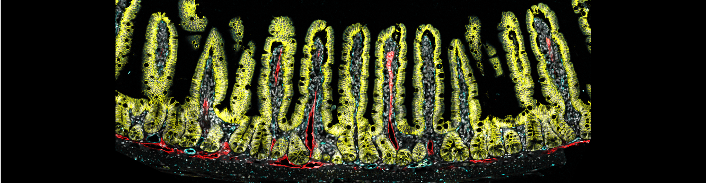 Mouse gut stained for enterocytes (yellow), blood vessels (cyan), and lymphatics (red)